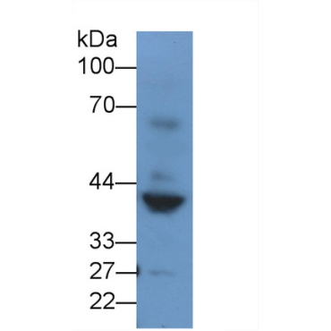 Renin (REN) Mouse Polyclonal Antibody