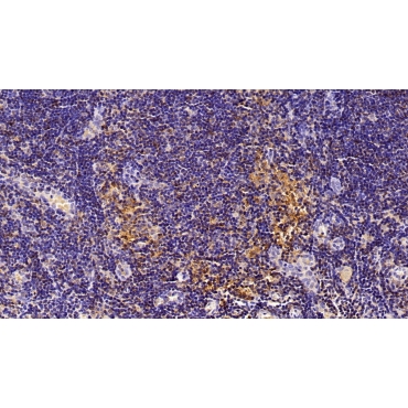 Arachidonate-15-Lipoxygenase (ALOX15) Human Polyclonal Antibody