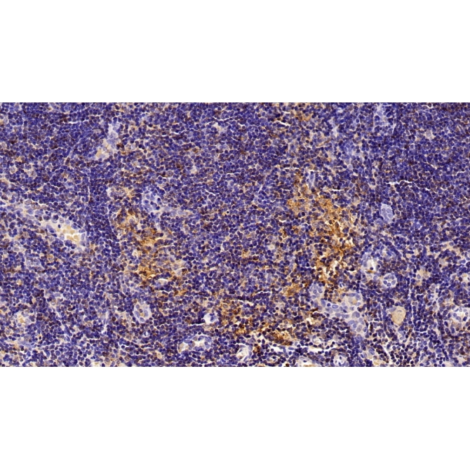 Arachidonate-15-Lipoxygenase (ALOX15) Human Polyclonal Antibody