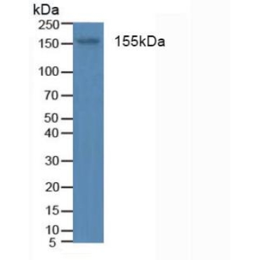 Insulin Receptor (INSR) Human Polyclonal Antibody