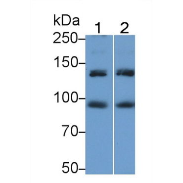 Insulin Receptor (INSR) Human Polyclonal Antibody