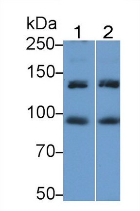 Insulin Receptor (INSR) Human Polyclonal Antibody