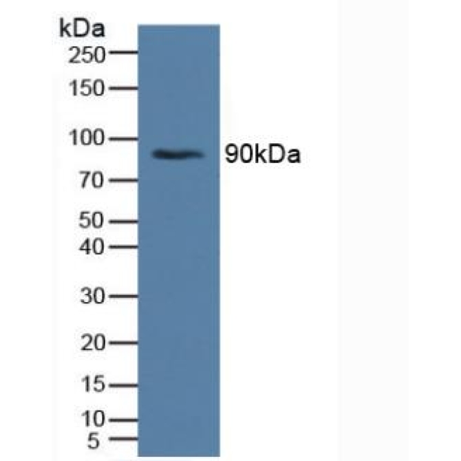 Insulin Receptor (INSR) Human Polyclonal Antibody