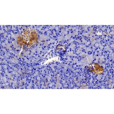 Insulin Receptor (INSR) Mouse Polyclonal Antibody