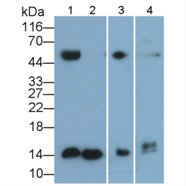 Cystatin C (Cys-C) Human Polyclonal Antibody