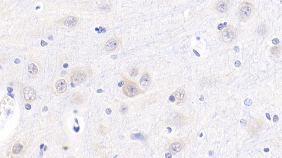 Cystatin C (Cys-C) Pig Polyclonal Antibody