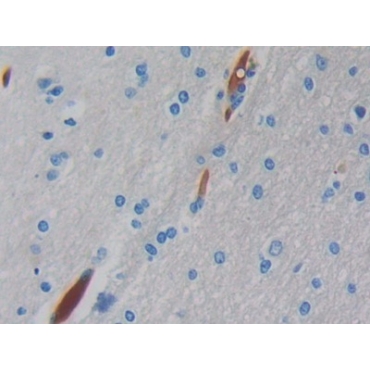 Hemoglobin Mu (HBm) Human Polyclonal Antibody