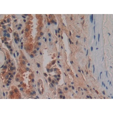 Osteopontin (OPN) Human Polyclonal Antibody