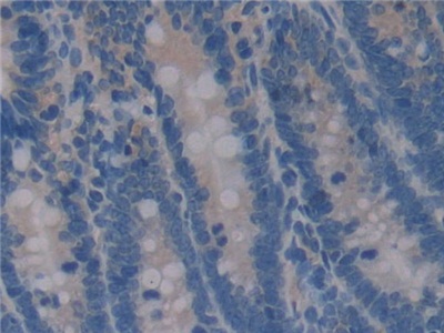 Osteopontin (OPN) Rat Polyclonal Antibody