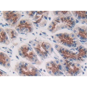 Acid Phosphatase 5, Tartrate Resistant (ACP5) Human Polyclonal Antibody