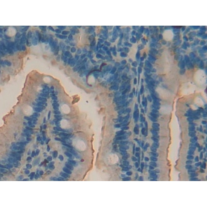 Acid Phosphatase 5, Tartrate Resistant (ACP5) Mouse Polyclonal Antibody
