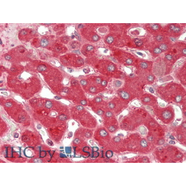 Ceruloplasmin (CP) Human Polyclonal Antibody