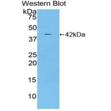 Ceruloplasmin (CP) Mouse Polyclonal Antibody