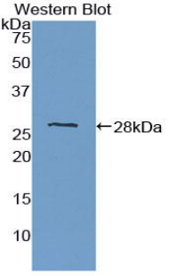 Protein Tyrosine Phosphatase Receptor Type M (PTPRM) Human Polyclonal Antibody