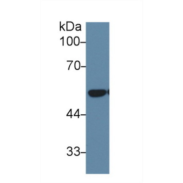 Dihydrolipoyl Dehydrogenase (DLD) Human Polyclonal Antibody