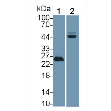 Tumor Protein p53 (P53) Human Polyclonal Antibody