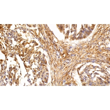 Tumor Protein p53 (P53) Human Polyclonal Antibody