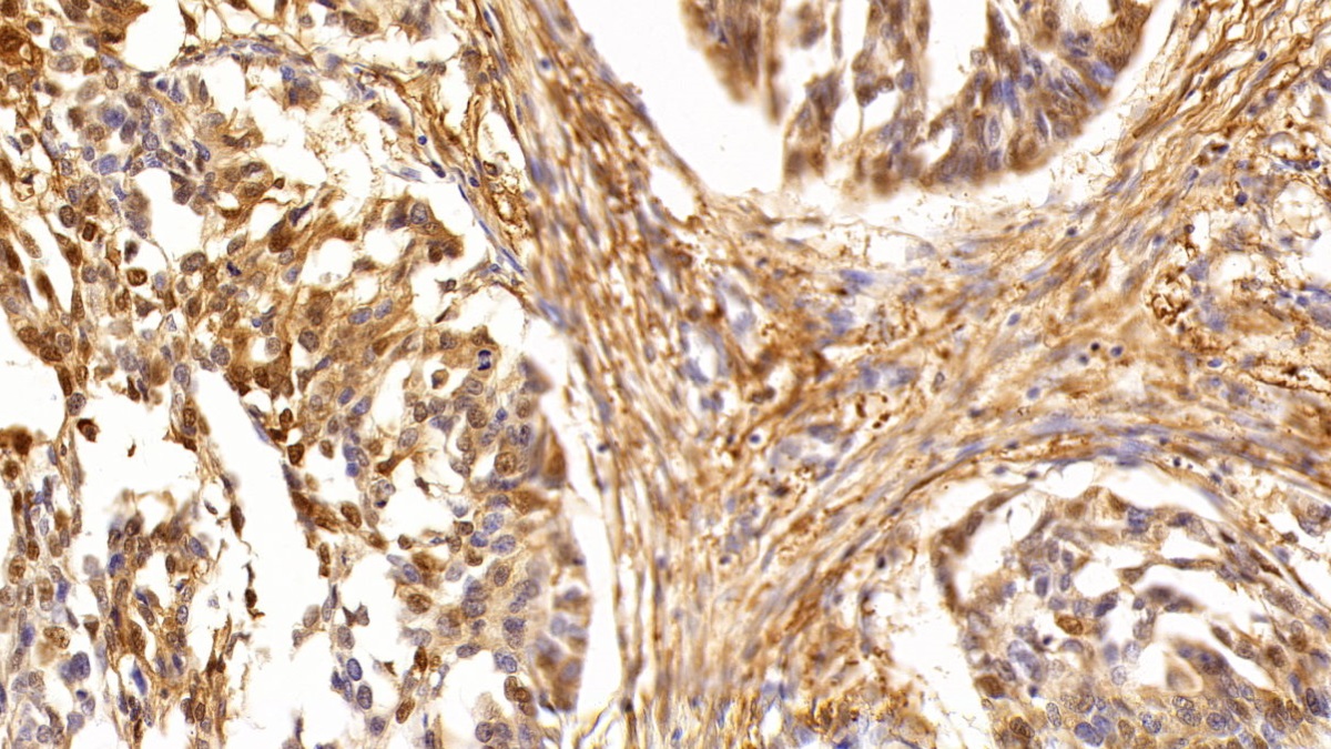 Tumor Protein p53 (P53) Human Polyclonal Antibody