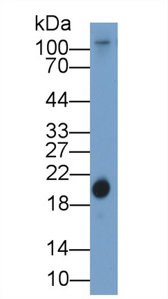 Retinol Binding Protein 4 (RBP4) Chicken (Gallus) Polyclonal Antibody