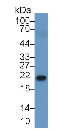 Retinol Binding Protein 4 (RBP4) Human Polyclonal Antibody