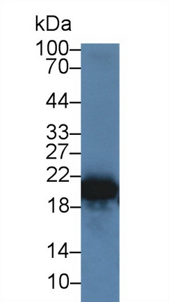 Retinol Binding Protein 4 (RBP4) Rabbit Polyclonal Antibody