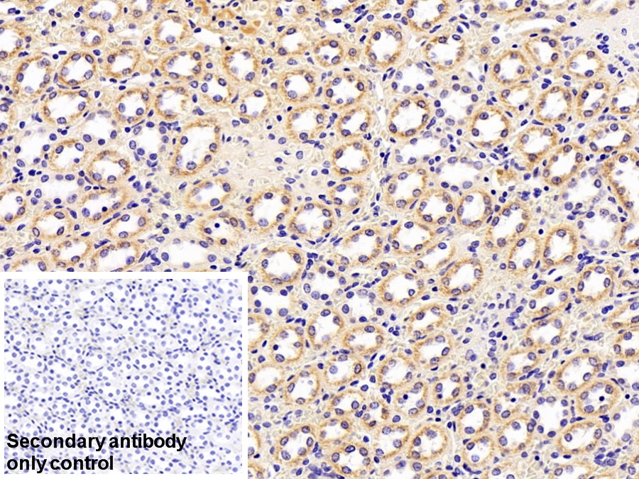 Retinol Binding Protein 4 (RBP4) Rabbit Polyclonal Antibody