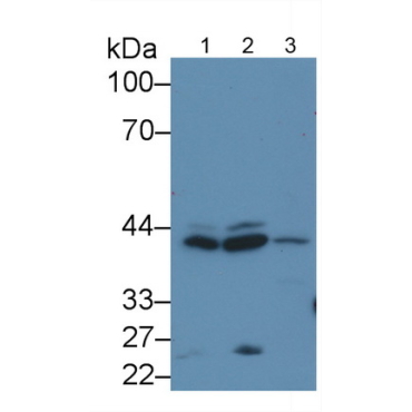 Extracellular Signal Regulated Kinase 2 (ERK2) Human Polyclonal Antibody