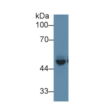 Protein Interacting With C Kinase 1 (PICK1) Mouse Polyclonal Antibody