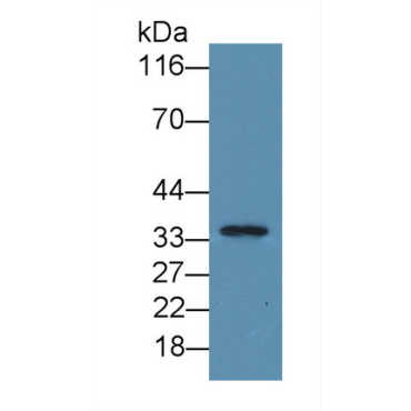 Intelectin 1 (ITLN1) Human Polyclonal Antibody