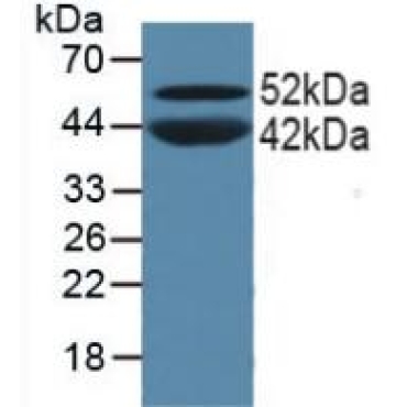 Peroxisome Proliferator Activated Receptor Alpha (PPARa) Human Polyclonal Antibody