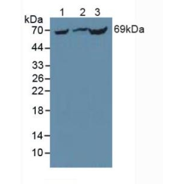 Phosphoenolpyruvate Carboxykinase 1, Soluble (PCK1) Mouse Polyclonal Antibody