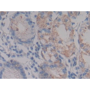 Nephrin (NPHN) Human Polyclonal Antibody