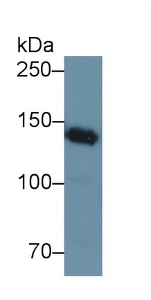 Nephrin (NPHN) Human Polyclonal Antibody