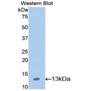 Nephrin (NPHN) Mouse Polyclonal Antibody