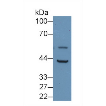 Podocin (PDCN) Human Polyclonal Antibody