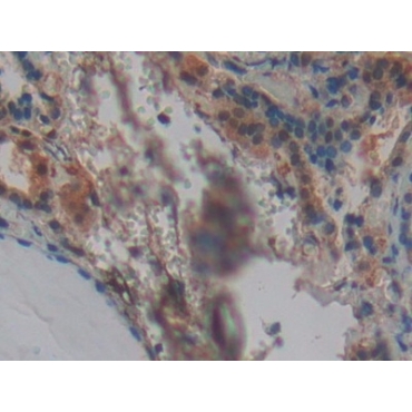 Gamma-synuclein (SNCG) Human Polyclonal Antibody