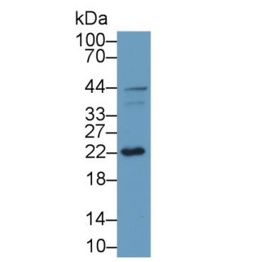 Gamma-synuclein (SNCG) Mouse Polyclonal Antibody