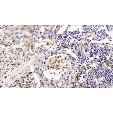Chemokine C-X-C-Motif Receptor 4 (CXCR4) Human Polyclonal Antibody