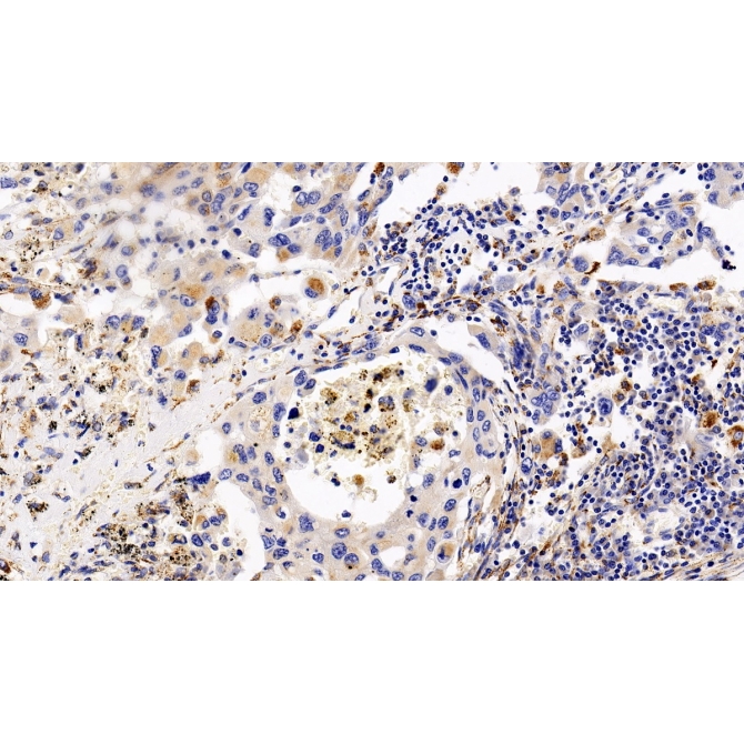 Chemokine C-X-C-Motif Receptor 4 (CXCR4) Human Polyclonal Antibody