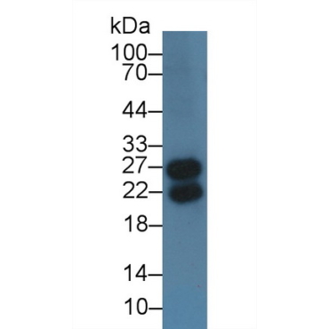 Immunoglobulin Lambda Like Polypeptide 1 (IglL1) Human Polyclonal Antibody