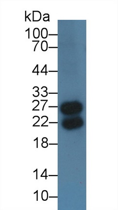 Immunoglobulin Lambda Like Polypeptide 1 (IglL1) Human Polyclonal Antibody