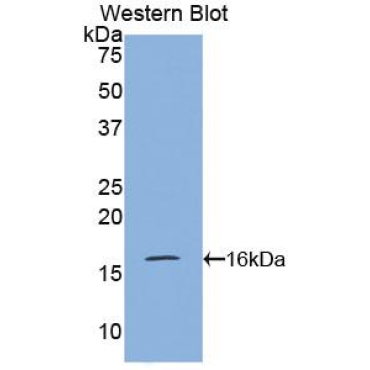 Pre-B-Lymphocyte Gene 1 (VPREB1) Mouse Polyclonal Antibody