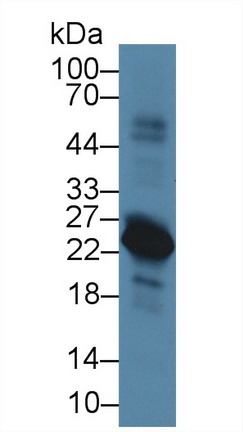 Pre-B-Lymphocyte Gene 1 (VPREB1) Rat Polyclonal Antibody