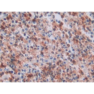 Neutrophil Specific Antigen 1 (NB1) Human Polyclonal Antibody