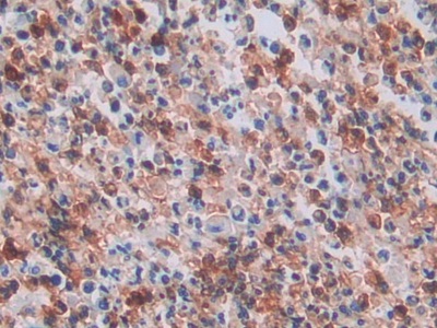 Neutrophil Specific Antigen 1 (NB1) Human Polyclonal Antibody