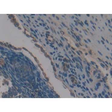 Neutrophil Specific Antigen 1 (NB1) Mouse Polyclonal Antibody