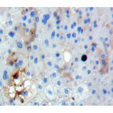 Fucosyltransferase 3 (FUT3) Human Polyclonal Antibody