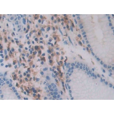 Chemerin (CHEM) Human Polyclonal Antibody