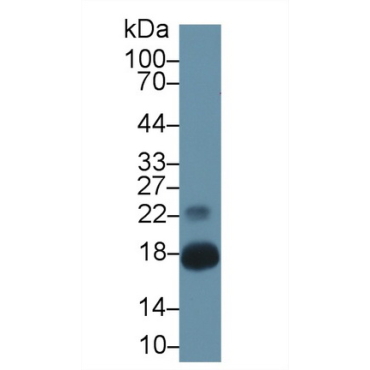 Chemerin (CHEM) Mouse Polyclonal Antibody