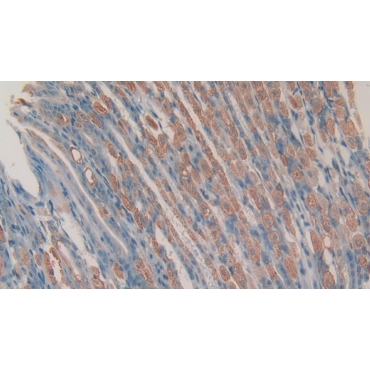 Chemerin (CHEM) Mouse Polyclonal Antibody